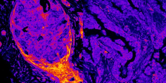 Οι επιστήμονες ανακαλύπτουν εκατοντάδες ενεργειακά ένζυμα που κάθονται απευθείας στο ανθρώπινο DNA Οι επιστήμονες ανακαλύπτουν εκατοντάδες ενεργειακά ένζυμα που κάθονται απευθείας στο ανθρώπινο DNA