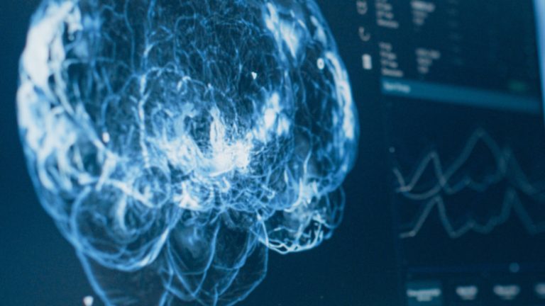 Η νευροχειρουργική ομάδα που φέρνει την καινοτομία στο χειρουργείο