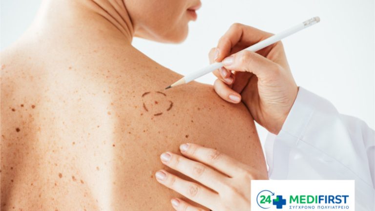 Νέος εξοπλισμός χαρτογράφησης σπίλων στο πολυϊατρείο Medifirst Περιστερίου