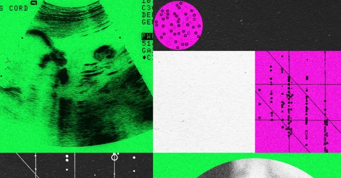 Αναταραχή στις εταιρείες σχεδίασης για μωρά Αναταραχή στις εταιρείες σχεδίασης για μωρά