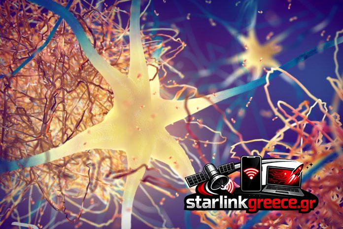 Ανακάλυψη: Πρωτεΐνη Alzheimer και η σημασία της στην κυτταρική διαίρεση Ανακάλυψη: Πρωτεΐνη Alzheimer και η σημασία της στην κυτταρική διαίρεση