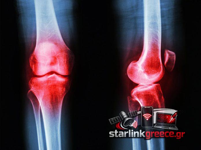 «Νέες ορμόνες υπόσχονται νέα θεραπεία για την αρθρίτιδα» «Νέες ορμόνες υπόσχονται νέα θεραπεία για την αρθρίτιδα»