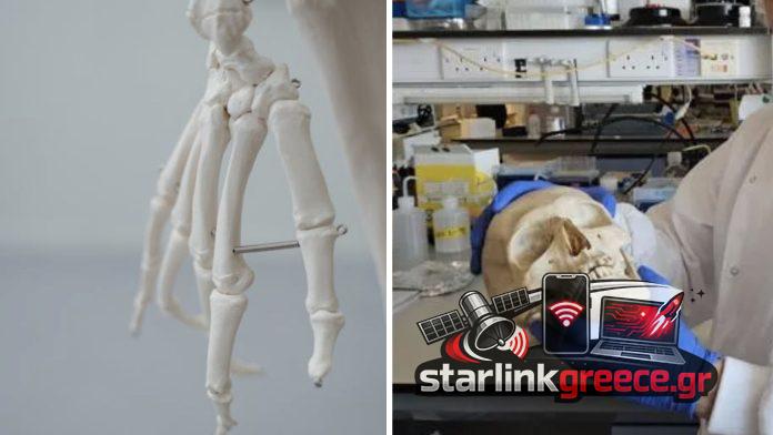 «Μαλλί μετατρέπεται σε βιώσιμο υλικό για αναγέννηση οστών» «Μαλλί μετατρέπεται σε βιώσιμο υλικό για αναγέννηση οστών»