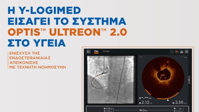 Η Y-Logimed φέρνει το OPTIS™ ULTREON™ 2.0 στην ΥΓΕΙΑ Η Y-Logimed φέρνει το OPTIS™ ULTREON™ 2.0 στην ΥΓΕΙΑ