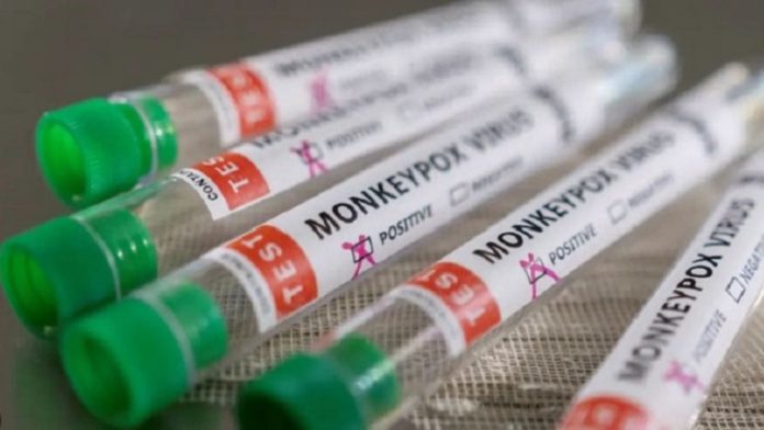 «Επιφυλακή στα Ιωάννινα: Εξάπλωση του ιού mpox στην Ελλάδα» «Επιφυλακή στα Ιωάννινα: Εξάπλωση του ιού mpox στην Ελλάδα»